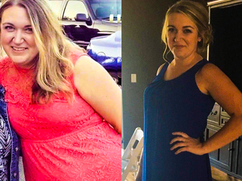 Before & After Success Before & After Success